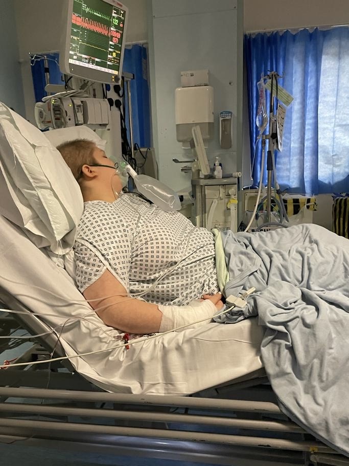 Young female with cancer, who is incredibly ill laying in a hospital bed receiving cancer treatment.