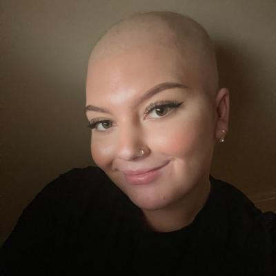 Young woman smiling, who hast lost her hair due to cancer treatment